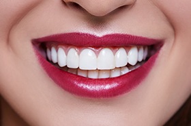 Closeup of flawless teeth and gums