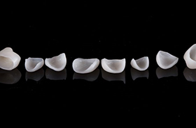 Line of dental restorations on dark reflective surface