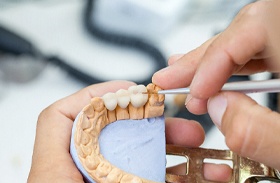 Hands working on porcelain dental bridge in laboratory
