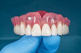 Full denture for upper arch resting on gloved hand