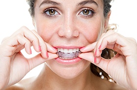 Woman placing Invisalign tray