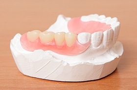 Partial denture on smile model