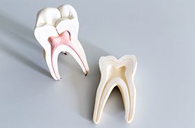 Tooth model showing root canals