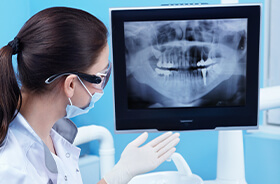 Dentist presenting 3D CT scan