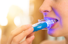 Woman using at-home teeth whitening system