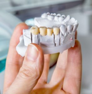 Hand holding tooth model with porcelain dental bridge in Branford