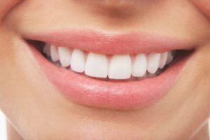 Woman’s bright smile after using free whitening in Branford