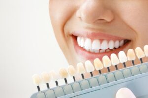 Woman’s bright smile next to dental shade guide